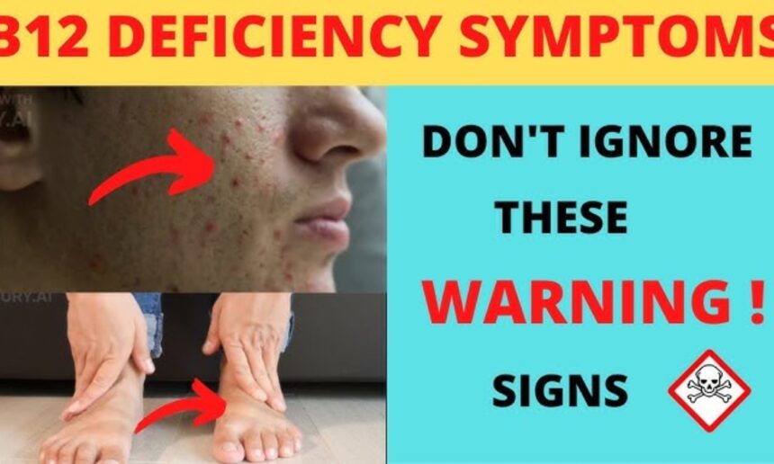 Vitamin B12 deficiency